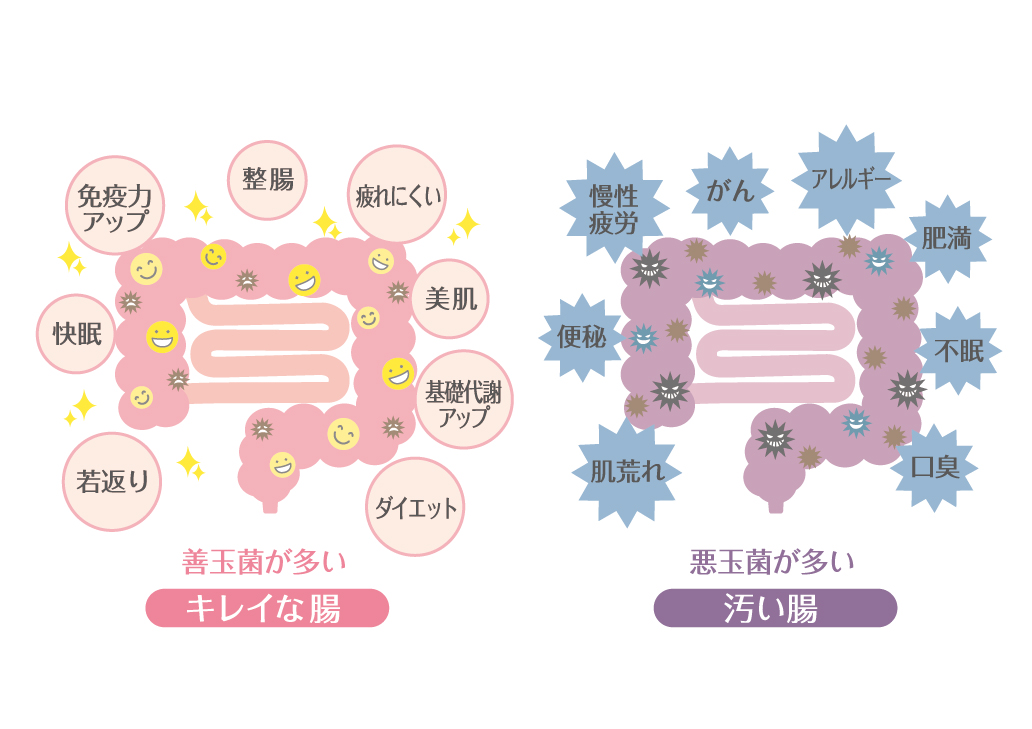 バイオジェニックスで腸内環境を整えよう！乳酸菌生産物質で善玉菌を守って増やす Insiders Memory